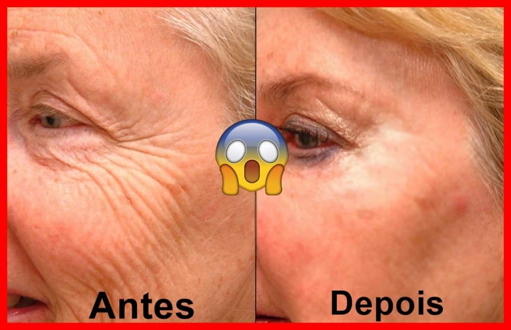 Máscaras para eliminar as rugas do rosto Máscaras para eliminar as rugas do rosto