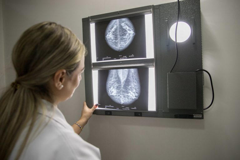 Cancelado debate sobre a importância do diagnóstico precoce de casos de câncer - Notícias 1 img20190607150250601